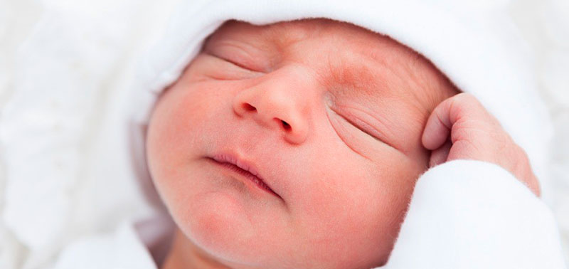 El acné puede aparecer en bebés